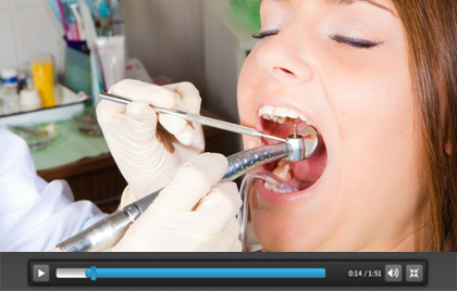 Dental Fillings and Restorations Chicago